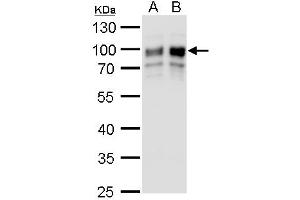 WB Image GOLPH2 antibody detects GOLPH2 protein by western blot analysis.