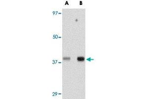 Western blot analysis of TREX1 in human spleen tissue lysate with TREX1 polyclonal antibody  at (A) 0. (TREX1 Antikörper  (Internal Region))