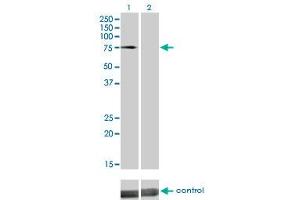 Western blot analysis of DMPK over-expressed 293 cell line, cotransfected with DMPK Validated Chimera RNAi (Lane 2) or non-transfected control (Lane 1). (DMPK Antikörper  (AA 303-420))