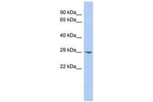 Image no. 1 for anti-Enoyl CoA Hydratase Domain Containing 2 (ECHDC2) (AA 143-192) antibody (ABIN6743494) (ECHDC2 Antikörper  (AA 143-192))