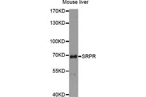 Western Blotting (WB) image for anti-Signal Recognition Particle Receptor (Docking Protein) (SRPR) antibody (ABIN1876968) (SRPR Antikörper)