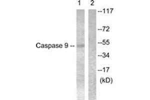 Western blot analysis of extracts from 293 cells, treated with Calyculin 50nM 30', using Caspase 9 (Ab-196) Antibody. (Caspase 9 Antikörper  (AA 162-211))