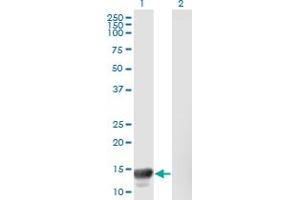 Western Blot analysis of MACF1 expression in transfected 293T cell line by MACF1 monoclonal antibody (M08), clone 1G9. (MACF1 Antikörper  (AA 1-95))