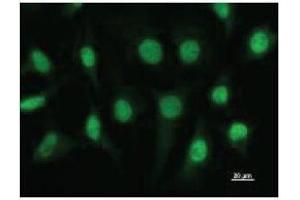 Immunostaining analysis in HeLa cells. (ETV3 Antikörper)