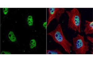 ICC/IF Image CHK1 antibody [C1C2-6], Internal detects Chk1 protein at nucleus by immunofluorescent analysis. (CHEK1 Antikörper)