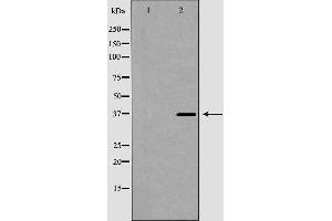 Western blot analysis of MCF7 cell lysate, using GP9 Antibody.