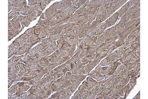 Immunohistochemistry (IHC) image for anti-ATPase, H+ Transporting, Lysosomal 50/57kDa, V1 Subunit H (ATP6V1H) (Center) antibody (ABIN2856776)