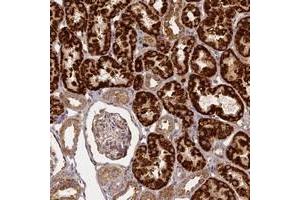 Immunohistochemical staining of human kidney with KRT78 polyclonal antibody  shows strong granular cytoplasmic positivity in cells in renal tubules. (Keratin 78 Antikörper)