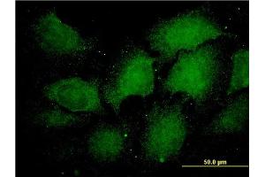 Immunofluorescence of monoclonal antibody to PSMA1 on HeLa cell. (PSMA1 Antikörper  (AA 1-263))