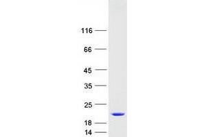 Validation with Western Blot