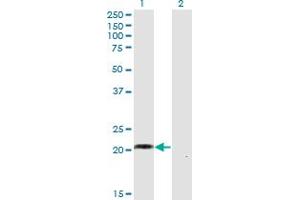 Western Blot analysis of WISP2 expression in transfected 293T cell line by WISP2 monoclonal antibody (M02), clone 1E11. (WISP2 Antikörper  (AA 24-250))