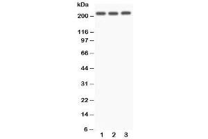 Western blot testing of NOTCH4 antibody and Lane 1:  A549 (NOTCH4 Antikörper  (C-Term))