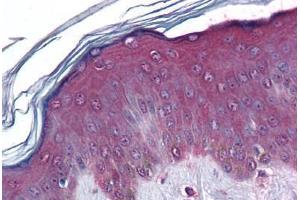 Human Skin: Formalin-Fixed, Paraffin-Embedded (FFPE)