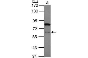 WB Image Sample (20 ug) A: HeLa nucleus 7. (ZNF449 Antikörper)