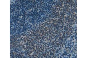 #VALUE! (Signaling Lymphocytic Activation Molecule Family, Member 2 (AA 27-243) Antikörper)