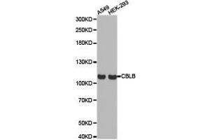 Western Blotting (WB) image for anti-Cbl Proto-Oncogene B, E3 Ubiquitin Protein Ligase (CBLB) antibody (ABIN1871488) (Cbl Proto-Oncogene B, E3 Ubiquitin Protein Ligase (CBLB) Antikörper)