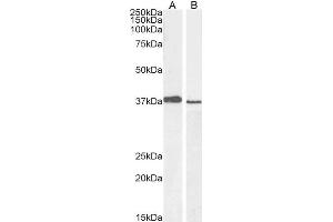ABIN184999 staining (1µg/ml) of A549 (A) and PD19 (B) cell lysate (RIPA buffer, 30µg total protein per lane). (PCGF2 Antikörper  (C-Term))
