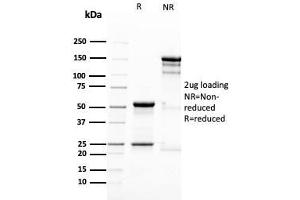 SDS-PAGE Analysis Purified Nestin Mouse Monoclonal Antibody (NES/2911). (Nestin Antikörper  (AA 698-844))