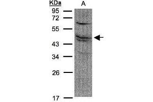 WB Image Sample(30 μg of whole cell lysate) A:A431, 12% SDS PAGE antibody diluted at 1:1500 (FDFT1 Antikörper)