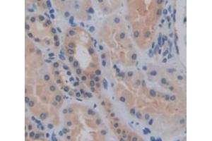 Immunohistochemistry (IHC) image for anti-Indian Hedgehog (IHH) (AA 240-399) antibody (ABIN1175999)