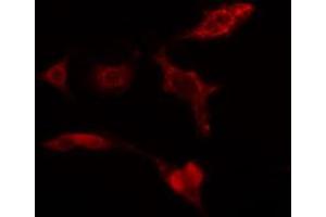 ABIN6274274 staining HuvEc cells by IF/ICC. (GALK1 Antikörper  (C-Term))