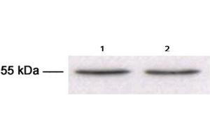 Western Blotting (WB) image for anti-Tubulin, beta 3 (TUBB3) antibody (ABIN1109374) (TUBB3 Antikörper)