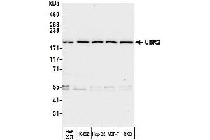 Western Blotting (WB) image for anti-Ubiquitin Protein Ligase E3 Component N-Recognin 2 (UBR2) (AA 1705-1755) antibody (ABIN7450869) (UBR2 Antikörper  (AA 1705-1755))