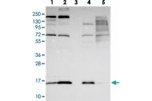 Western blot analysis of Lane 1: RT-4, Lane 2: U-251 MG, Lane 3: Human Plasma, Lane 4: Liver, Lane 5: Tonsil with COX20 polyclonal antibody  at 1:250-1:500 dilution. (FAM36A Antikörper)