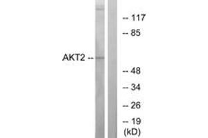 Western blot analysis of extracts from A2780 cells, treated with TNF-alpha, using Akt2 (Ab-474) Antibody.