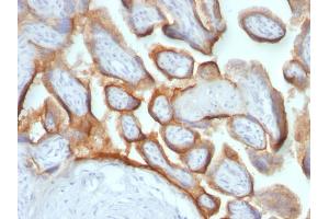 Formalin-fixed, paraffin-embedded human Placenta stained with hCG beta Mouse Monoclonal Antibody (HCGb/54 + HCGb/459).