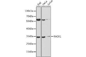 Western blot analysis of extracts of various cell lines, using R antibody (ABIN6131708, ABIN6141226, ABIN6141228 and ABIN6217372) at 1:1000 dilution. (GNB2L1 Antikörper  (AA 30-290))