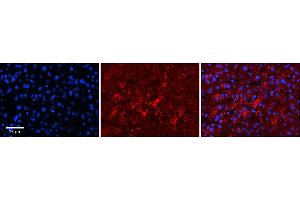 Rabbit Anti-LYPLA2 Antibody  Catalog Number: ARP58638_P050 Formalin Fixed Paraffin Embedded Tissue: Human Adult Liver  Observed Staining: Cytoplasm in hepatocytes, strong signal, low tissue distribution Primary Antibody Concentration: 1:100 Secondary Antibody: Donkey anti-Rabbit-Cy3 Secondary Antibody Concentration: 1:200 Magnification: 20X Exposure Time: 0.