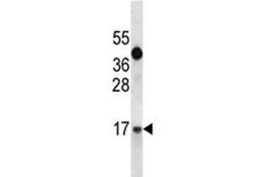 Western Blotting (WB) image for anti-Insulin-Like Growth Factor 1 (IGF1) (AA 115-144) antibody (ABIN3031342)