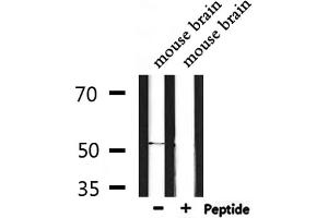 Western blot analysis of extracts from mouse brain, using ETBR2 Antibody. (GPR37L1 Antikörper  (N-Term))