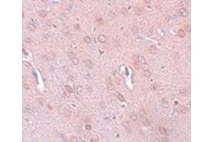 Immunohistochemistry of TRESK in rat brain tissue with this product at 5 μg/ml.