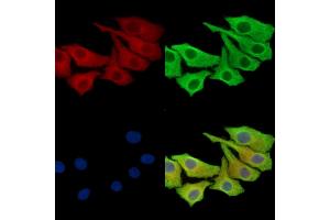 ABIN7097062 and ABIN7101129 staining Hela cells by IF/ICC.