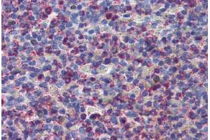 Anti-CYSLTR2 / CYSLT2 antibody  ABIN1048489 IHC staining of human spleen.