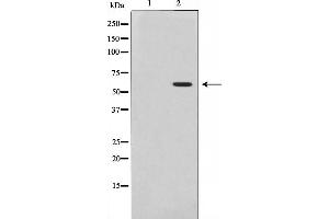 Western blot analysis of Akt phosphorylation expression in Insulin treated 293 whole cell lysates,The lane on the left is treated with the antigen-specific peptide.
