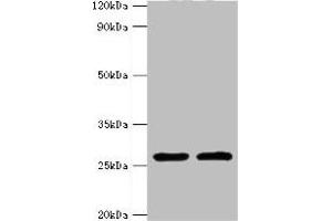 Western blot All lanes: ACRV1 antibody at 4 μg/mL Lane 1: Mouse liver tissue Lane 2: Mouse gonad tissue Secondary Goat polyclonal to rabbit IgG at 1/10000 dilution Predicted band size: 29, 27, 23, 21, 20, 19, 18, 17, 14, 9 kDa Observed band size: 29 kDa (ACRV1 Antikörper  (AA 22-265))