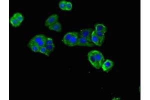 Immunofluorescent analysis of HepG2 cells using ABIN7150865 at dilution of 1:100 and Alexa Fluor 488-congugated AffiniPure Goat Anti-Rabbit IgG(H+L) (DNAH12 Antikörper  (AA 2423-2632))