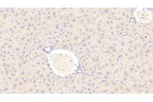 Immunohistochemistry (IHC) image for anti-Serpin Peptidase Inhibitor, Clade G (C1 Inhibitor), Member 1 (SERPING1) (AA 211-331) antibody (ABIN7431431)