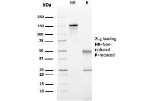 SDS-PAGE Analysis Purified IgG Mouse Recombinant Monoclonal Antibody (rIG266). (Rekombinanter IGHG Antikörper)