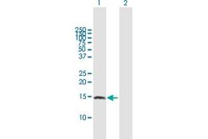 Western Blot analysis of ZNRD1 expression in transfected 293T cell line by ZNRD1 MaxPab polyclonal antibody. (ZNRD1 Antikörper  (AA 1-126))