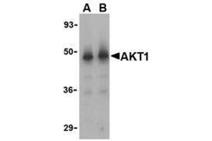 Western blot analysis of Akt1 in human liver cell lysate with AP30042PU-N Akt1 antibody at (A) 1 and (B) 2 μg/ml.