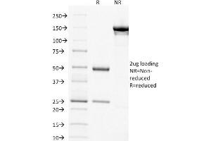 SDS-PAGE (SDS) image for anti-Thymidylate Synthetase (TYMS) (AA 60-174) antibody (ABIN6940822)