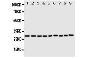 Anti-Peroxiredoxin 3 antibody, Western blotting All lanes: Anti Peroxiredoxin 3  at 0. (Peroxiredoxin 3 Antikörper  (C-Term))
