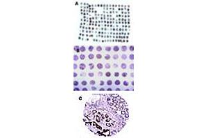 Formalin-fixed, paraffin-embedded tissue human colon microarray stained for CARD8 expression at 1 : 2000.