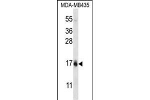 HIST1H2BC/HIST1H2BF Antibody (N-term) (ABIN656773 and ABIN2845992) western blot analysis in MDA-M cell line lysates (35 μg/lane).