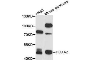 Western blot analysis of extracts of various cell lines, using HOXA2 antibody (ABIN5995946) at 1/1000 dilution. (HOXA2 Antikörper)
