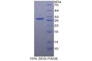 SDS-PAGE analysis of Human GSTk1 Protein. (GSTK1 Protein)